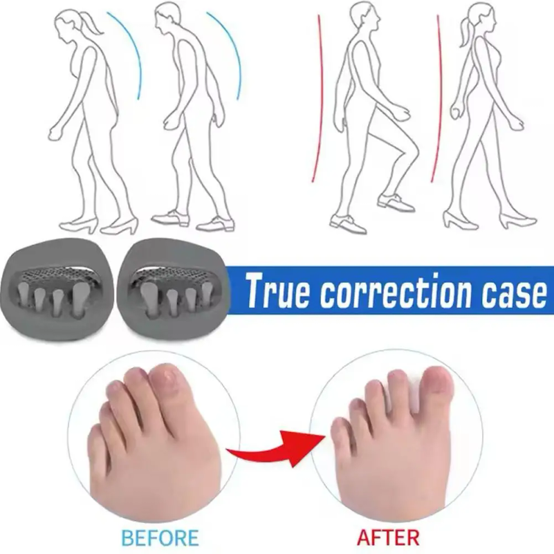 Leg Correction Slippers Scient - đánh giá và giá Home Improvement Man
